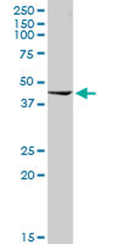 ACADM purified MaxPab rabbit polyclonal antibody (D01P)