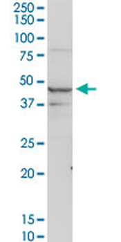 ACADM purified MaxPab rabbit polyclonal antibody (D01P)