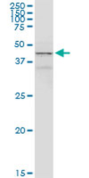 ACADM purified MaxPab rabbit polyclonal antibody (D01P)