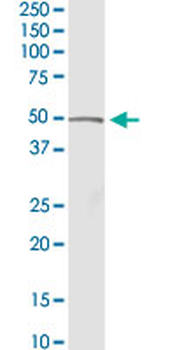 ACADM purified MaxPab rabbit polyclonal antibody (D01P)