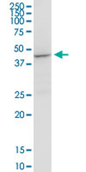 ACADM purified MaxPab rabbit polyclonal antibody (D01P)