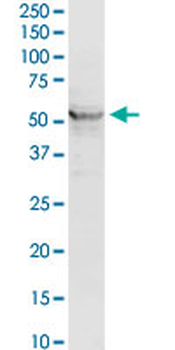 ACADM purified MaxPab rabbit polyclonal antibody (D01P)