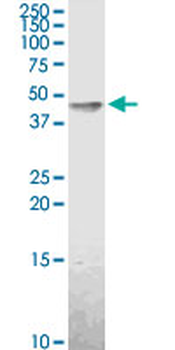 ACADM purified MaxPab rabbit polyclonal antibody (D01P)