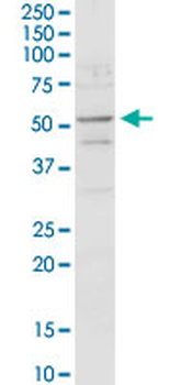 ACADM purified MaxPab rabbit polyclonal antibody (D01P)