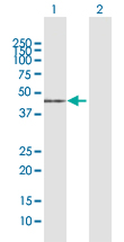 ACADM MaxPab rabbit polyclonal antibody (D01)