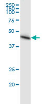 ACADM MaxPab rabbit polyclonal antibody (D01)