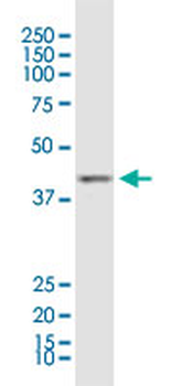 ACAA1 monoclonal antibody (M01), clone 3F11