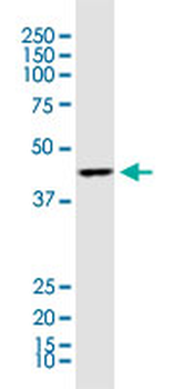 ACAA1 monoclonal antibody (M01), clone 3F11