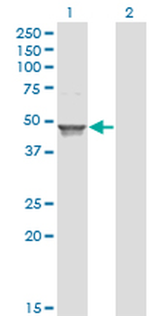 ACAA1 monoclonal antibody (M01), clone 3F11