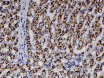 ACAA1 monoclonal antibody (M01), clone 3F11