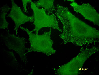 ACAA1 monoclonal antibody (M01), clone 3F11