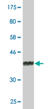 ACAA1 monoclonal antibody (M01), clone 3F11