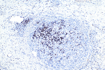 Multi-rAb Polymer HRP-Goat Anti-Rabbit Recombinant Secondary Antibody (H+L)