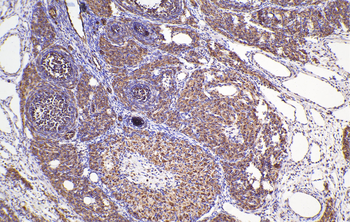 Multi-rAb Polymer HRP-Goat Anti-Rabbit Recombinant Secondary Antibody (H+L)