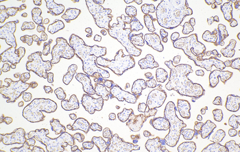 Multi-rAb Polymer HRP-Goat Anti-Rabbit Recombinant Secondary Antibody (H+L)