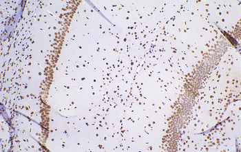 Multi-rAb Polymer HRP-Goat Anti-Rabbit Recombinant Secondary Antibody (H+L)