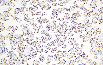 Multi-rAb Polymer HRP-Goat Anti-Rabbit Recombinant Secondary Antibody (H+L)