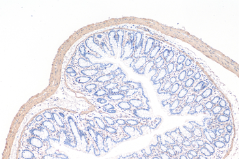 Multi-rAb Polymer HRP-Goat Anti-Rabbit Recombinant Secondary Antibody (H+L)