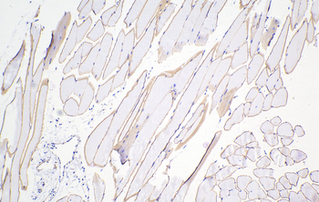 Multi-rAb Polymer HRP-Goat Anti-Rabbit Recombinant Secondary Antibody (H+L)