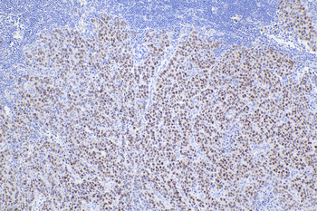 Multi-rAb Polymer HRP-Goat Anti-Rabbit Recombinant Secondary Antibody (H+L)