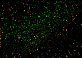 Multi-rAb CoraLite Plus 555-Goat Anti-Rabbit Recombinant Secondary Antibody (H+L)