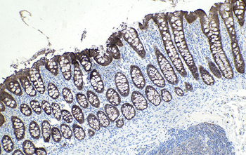 Multi-rAb Polymer HRP-Goat Anti-Mouse Recombinant Secondary Antibody (H+L)
