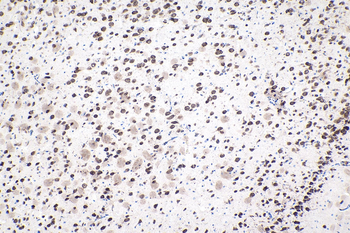 Multi-rAb Polymer HRP-Goat Anti-Mouse Recombinant Secondary Antibody (H+L)