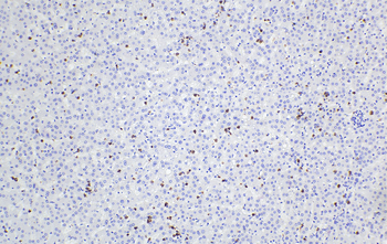 Multi-rAb Polymer HRP-Goat Anti-Mouse Recombinant Secondary Antibody (H+L)