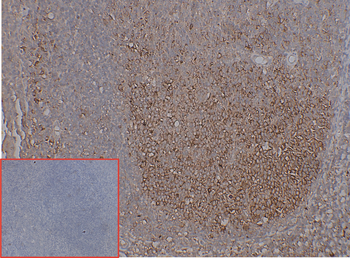 GPRC5D Antibody