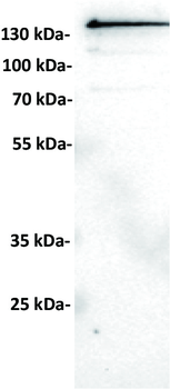 ROR2 Antibody