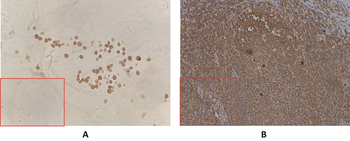 BAFF-R Antibody