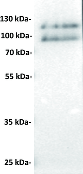 CD30 Antibody