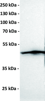 CCR1 Antibody