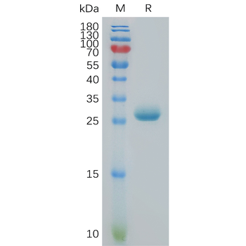 Human ANGPT2(275-496) Protein, His Tag