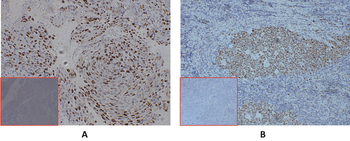 CXADR Antibody