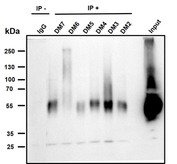 BCMA Antibody