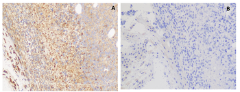 GPRC5D Antibody