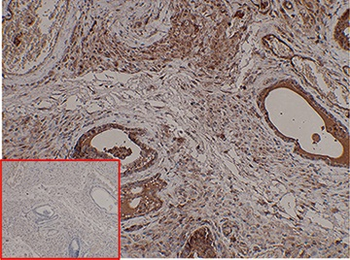 PSCA Antibody