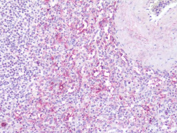 Leukotriene B4 Receptor/BLT1 Antibody