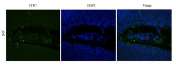 IL-2R alpha antibody