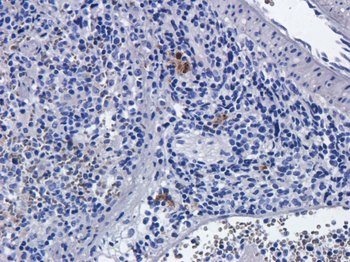 IL-2R alpha antibody