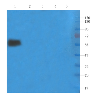 IL-2R alpha antibody