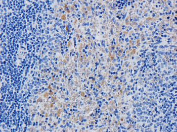 IL-2R antibody