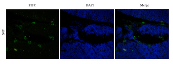 CD52 antibody