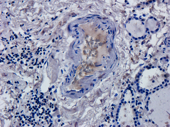 CD52 antibody