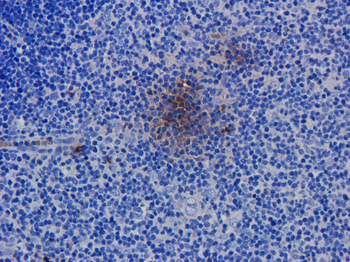 CD52 antibody