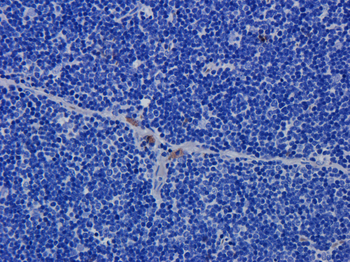 CD52 antibody