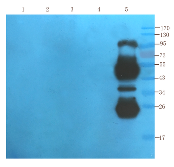 CD25 antibody