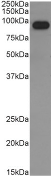 IgM antibody