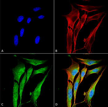 VAChT Antibody: HRP